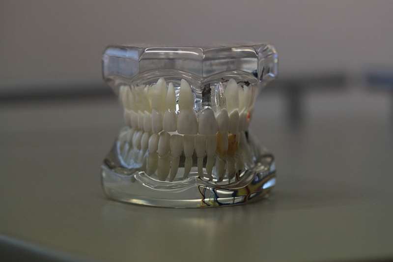 zobne proteze